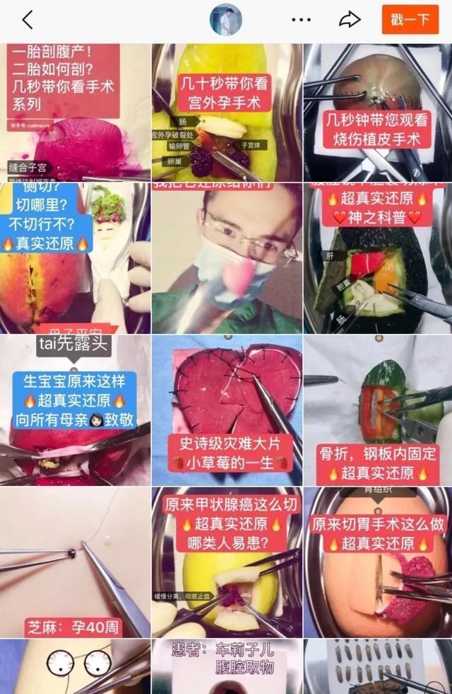 手术|给火龙果割阑尾33岁水果医生爆红吸粉90万网友看到第一个就痛了