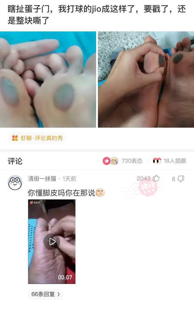 |搞笑神评：中国禁止近亲结婚，那为什么我爷爷娶了我奶奶？