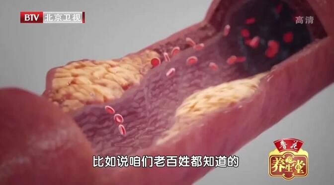 风湿病是如何影响心血管的？