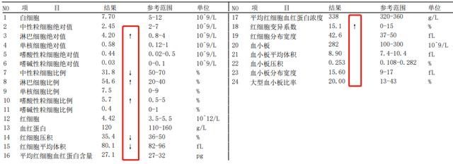 血小板|一文读懂血常规报告，这几项指标异常时要警惕白血病