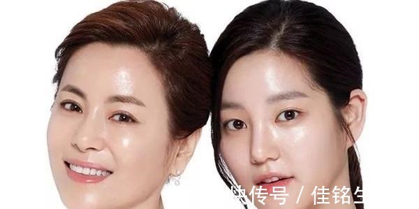 水光 医美干货分享水光针适合你吗!