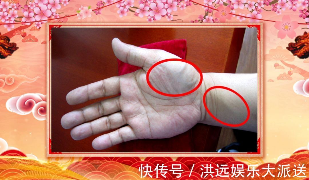 慢性心衰|身体好不好,看手就知道!这几处变化可能藏大病