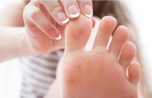 糖尿病患者|血糖升高，双脚会出现3种变化，若你有，及时测血糖，别忽视