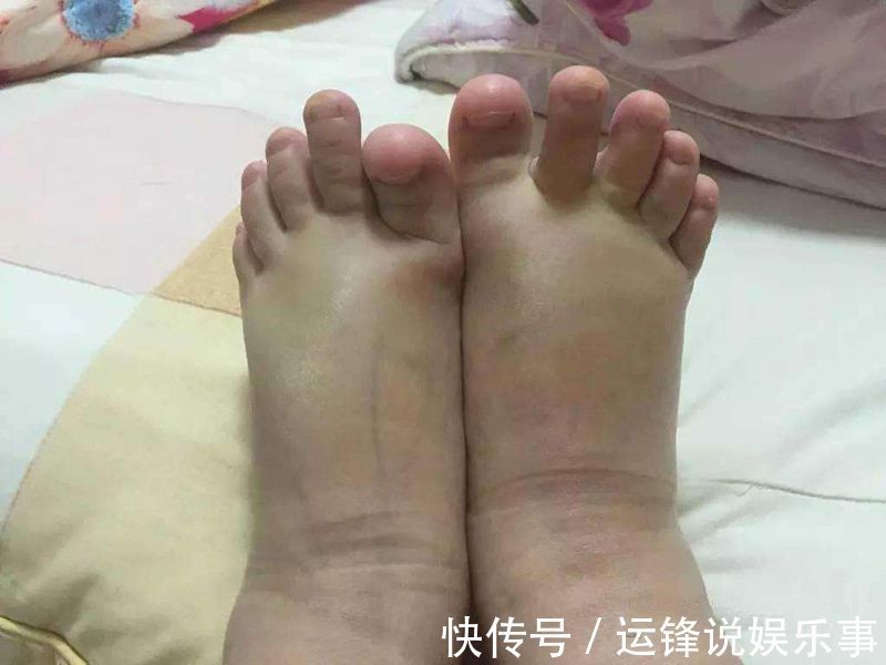 孕晚期|孕晚期这3件“尴尬事”,是胎儿在释放健康信号,孕妈不用紧张