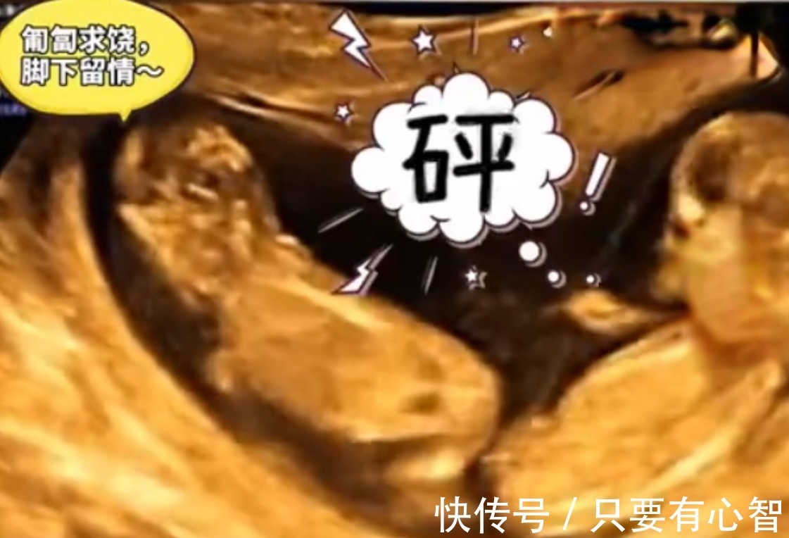 四维彩超|孕妈做四维彩超时突然腹痛,B超显示让人忍俊不禁,网友:挺无辜