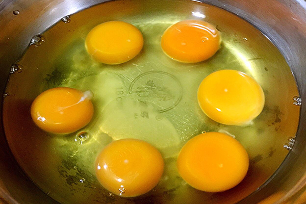 血糖|糖尿病患者需谨记，除了少吃糖，4种食物也要少碰，以防血糖过高