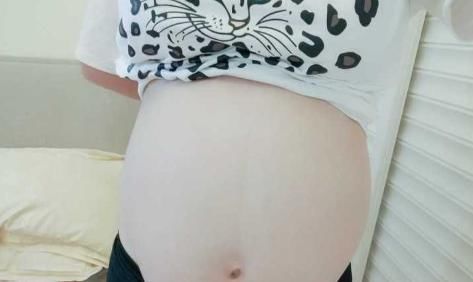 妊娠|“四维彩超通过了,为何胎儿还会畸形”孕妈要多留心眼