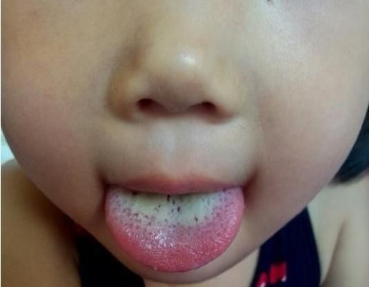 拇指|孩子积食怎么办?中医师:身上有2个“消食穴”,揉一揉消除积食