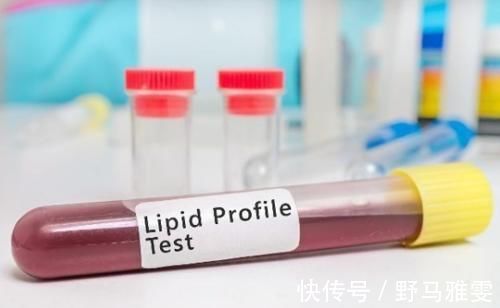 降脂|悄悄告诉你,此3种水果都可以降脂,血脂高的人万万不要错过