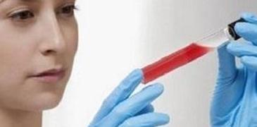 服用|血脂异常对心血管有什么危害呢?服用他汀该注意什么?