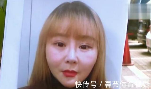 甘女士|花了13000元做脸部埋线,术后美颜相机都救不了?姑娘:脸更胖了
