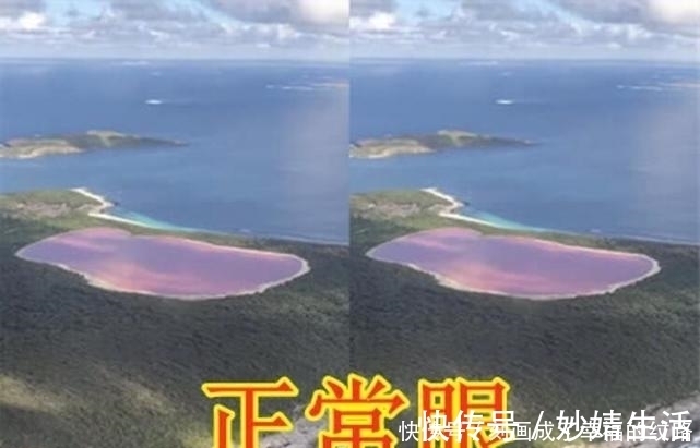 近视眼|“近视眼”有多惨?二百度还凑合,六百度看不清,看到八百度:已瞎