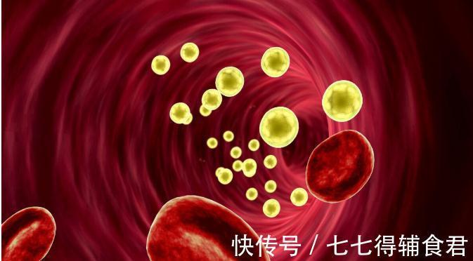 发生率|房颤让卒中风险高好几倍!权威专家教你如何正确对待