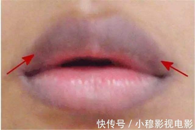 解毒|肝脏毒素增多了?嘴唇会有3个现象,若你1个都无,恭喜肝脏很干净