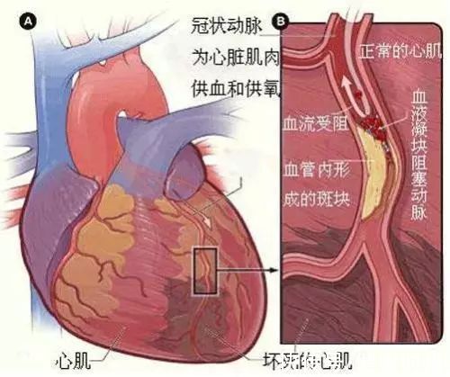 患者|谣言真的害人！只因做错了一件事，夫妻阴阳两隔