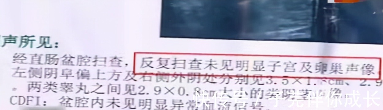 父母|女子怀孕吃打胎药,10岁双胞胎女儿长出喉结,母亲:出生就有问题