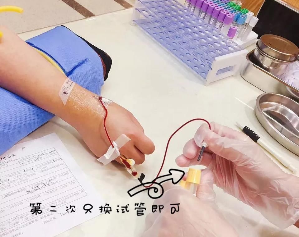 检查|提前1周调整饮食,喝完糖水后多走动,糖耐检测你“作弊”了吗?