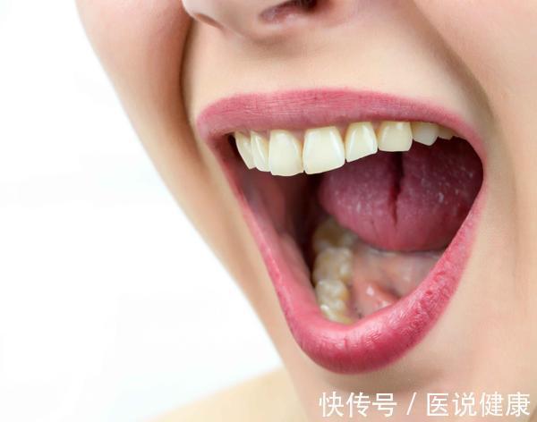 肿块|口腔癌发生时,会有5种异常表现,及时检查,避免错过治疗时期