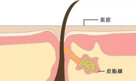 博士|痘博士给你的祛痘建议