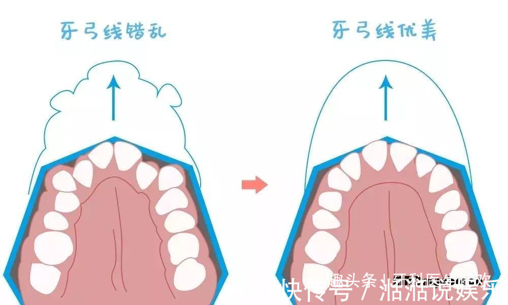 口腔|儿童这些不良习惯，是导致牙齿不齐的原因所在！