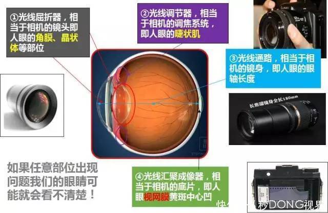 高度近视|不近视的预防近视,已经近视的控制近视度数加深,避免成高度近视