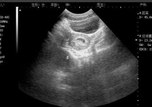 怀孕|并非所有的怀孕都能第一时间发现,准妈妈要注意的,按周来感觉