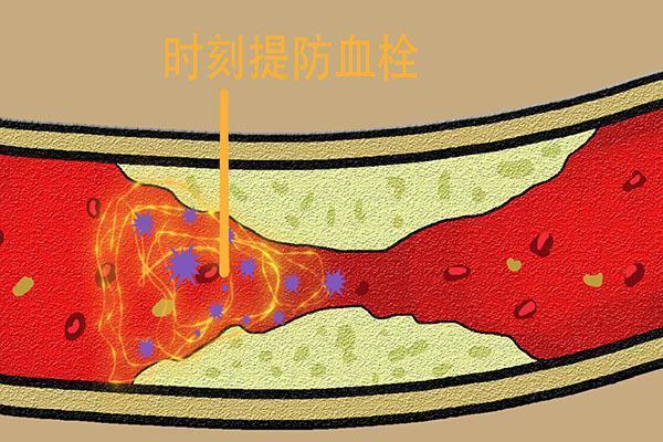 改善|脚上有一个“化血栓开关”,按一按,就能清血毒,防血栓