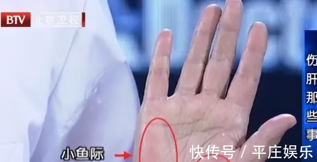 曲池穴|体内湿气太重怎么祛除?中医师:有这三招就够了