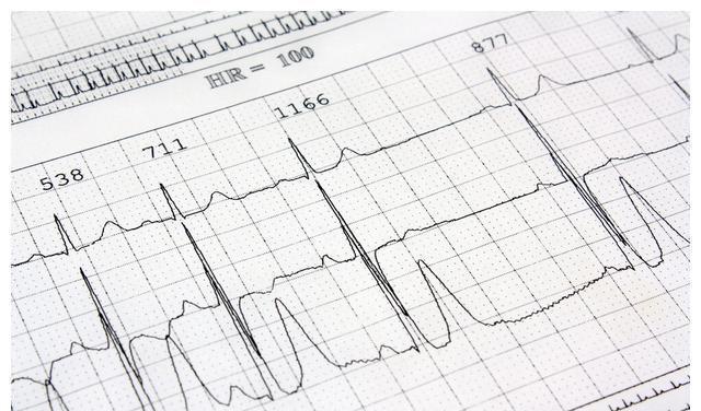 超声检查|初次诊断高血压，需要做哪些检查？医生提醒：这8项检查不能少