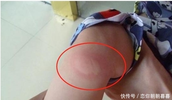 夏天|驱蚊只能用蚊香？老一辈都是一盆水就能搞定，效果好操作简易