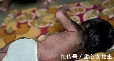 小两口|32岁产妇生下”猴子”,小两口崩溃大哭,医生看到宝宝后却笑了