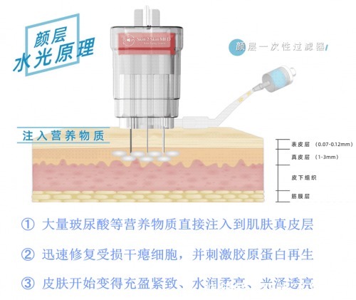 答案|打了水光没效果？颜层水光告诉你答案