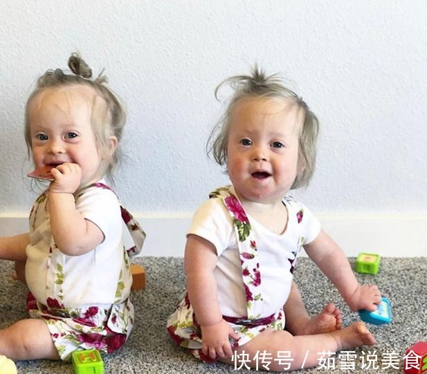 唐氏双胞胎|妈妈生下唐氏双胞胎姐妹，并不轻言放弃，唐宝都有一张相同的脸