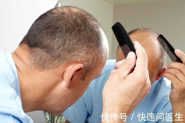 脱发|男性开始衰老时，排尿无力，肚子变大，脱发可渐渐出现