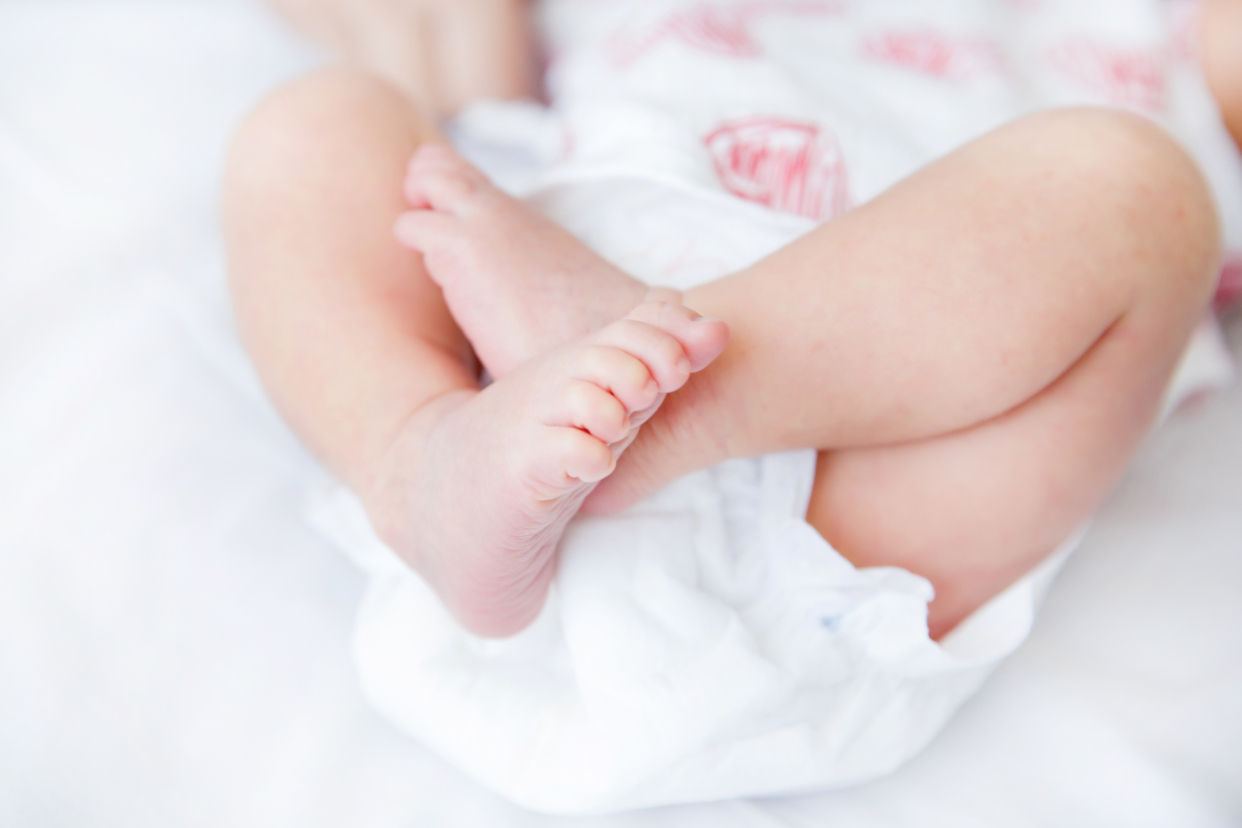 双腿|宝宝臀纹不对称,可能是这2个原因导致的,家长别忽视