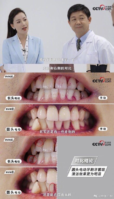 口腔健康|你可能每天在无效刷牙