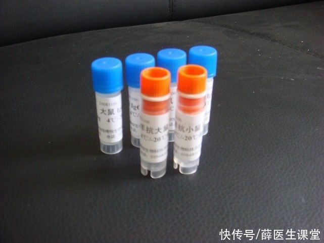 高血脂|高血脂“缠上”的人，都有这4个特征，占得越多，血脂超标越严重