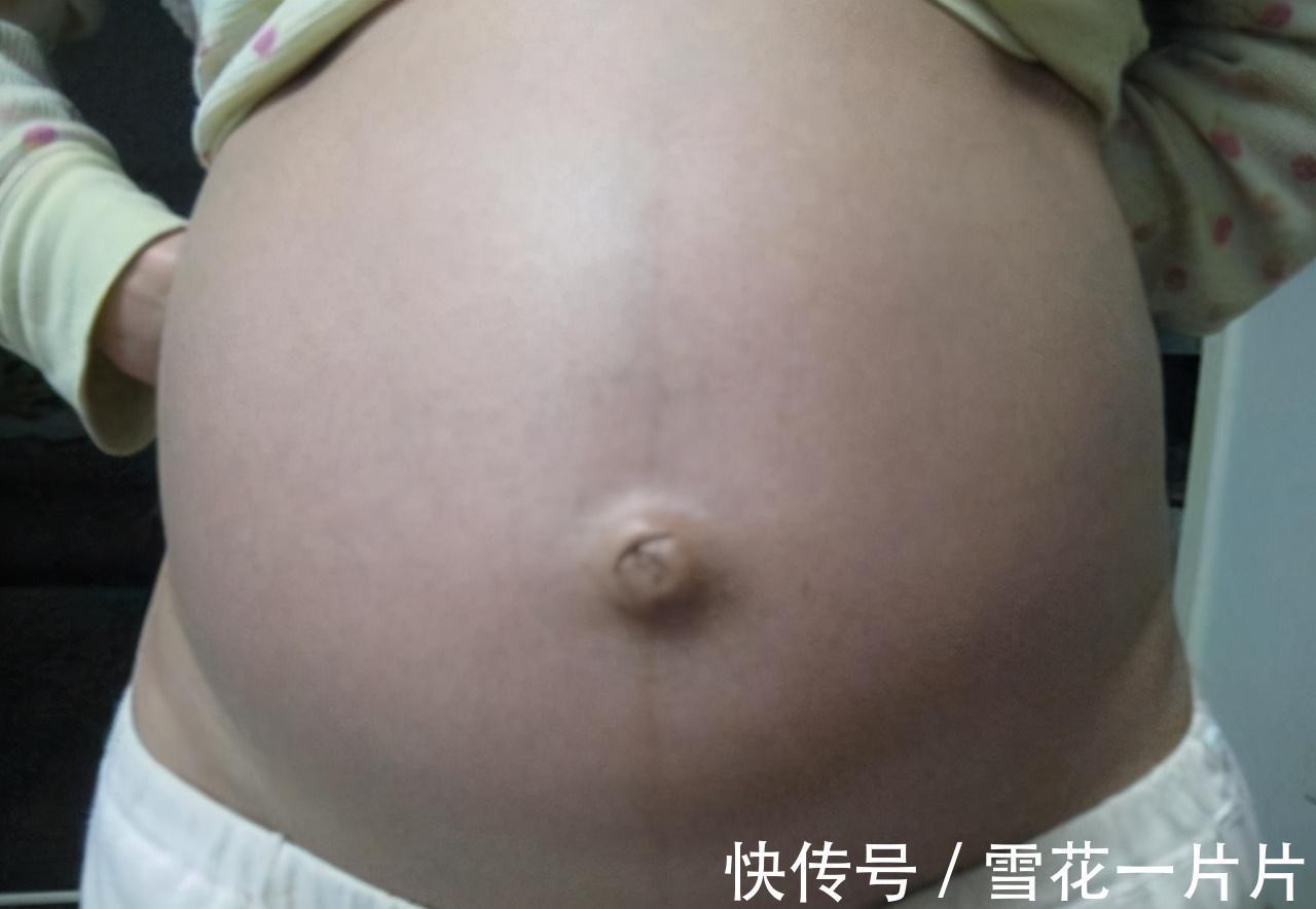 肚脐眼|怀的是男孩还是女孩,看孕妈肚脐“凹凸”就知道?科学解释在这里