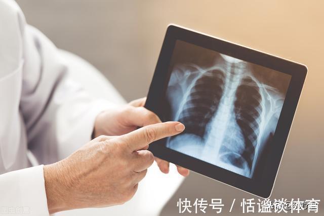 异常|肺部有癌,睡眠当知,睡觉时这些“异常”出现,尽快去医院排查