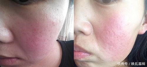 桃子|孕妈太“馋”水蜜桃,妈妈见状只好劝阻怀孕后不能吃太多桃子