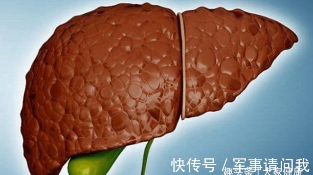 香蕉|肝不好能吃葡萄吗?医生:想养护肝脏,这3种水果,平时少吃为好