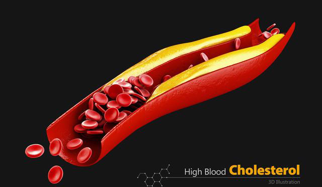 高密度脂蛋白|血脂升高可以说是现代人多种疾病的起源，有什么办法能够降低血脂