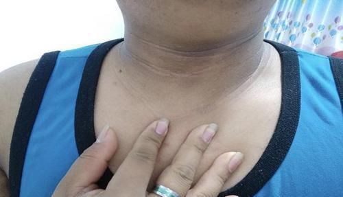 花花|6岁女儿脖颈发黑洗不掉,送医院检查,医生的解释令宝妈哭笑不得