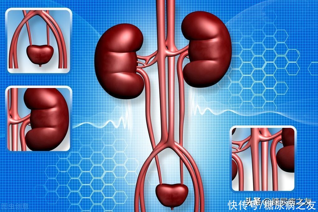糖尿病|糖尿病患者千万别等身体出现水肿再去检查肾脏，错过最佳治疗时机，后悔就晚了