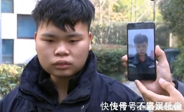 结果|小伙子为了求婚,做面部吸脂手术,结果反而更胖