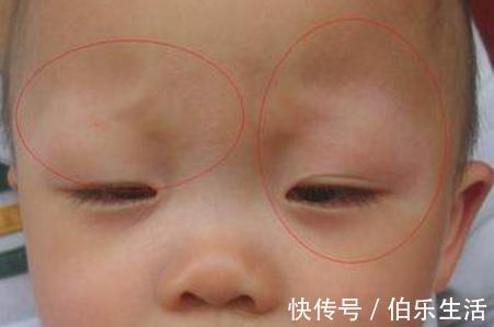 段日子|满月宝宝被奶奶剃光眉毛,2个月后家人泪流满面,医生迷信坑人
