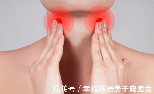 癌变|别小看甲状腺结节,控制不好可能癌变!医生:记住3多吃,2少吃