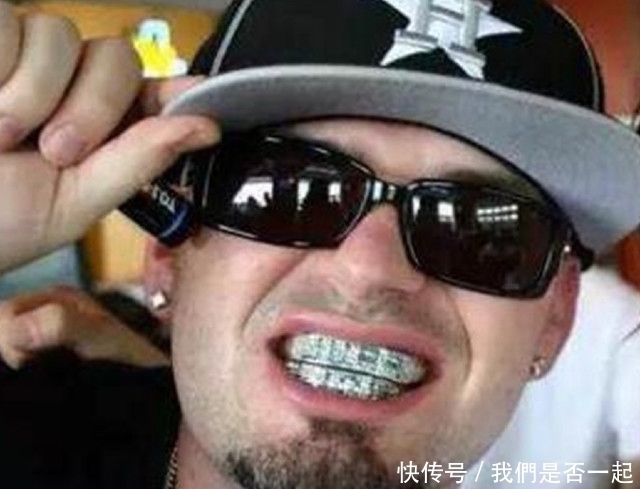 钻石|土豪的世界我们果然不懂,牙齿上面镶钻,你能接受吗?