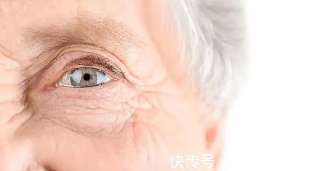 血液粘稠|内科医生:血脂升高,脸部会给你“暗示”,及时检查,不要拖延