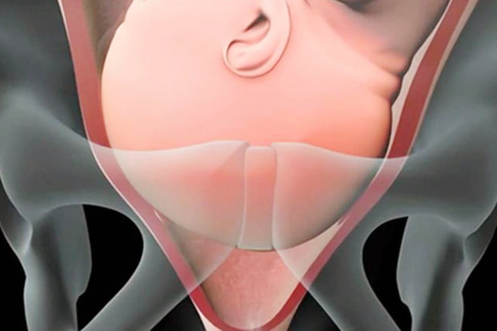 双顶径|“胎儿头大不能顺产”产前双顶径多大,孕妈才能顺利自然分娩